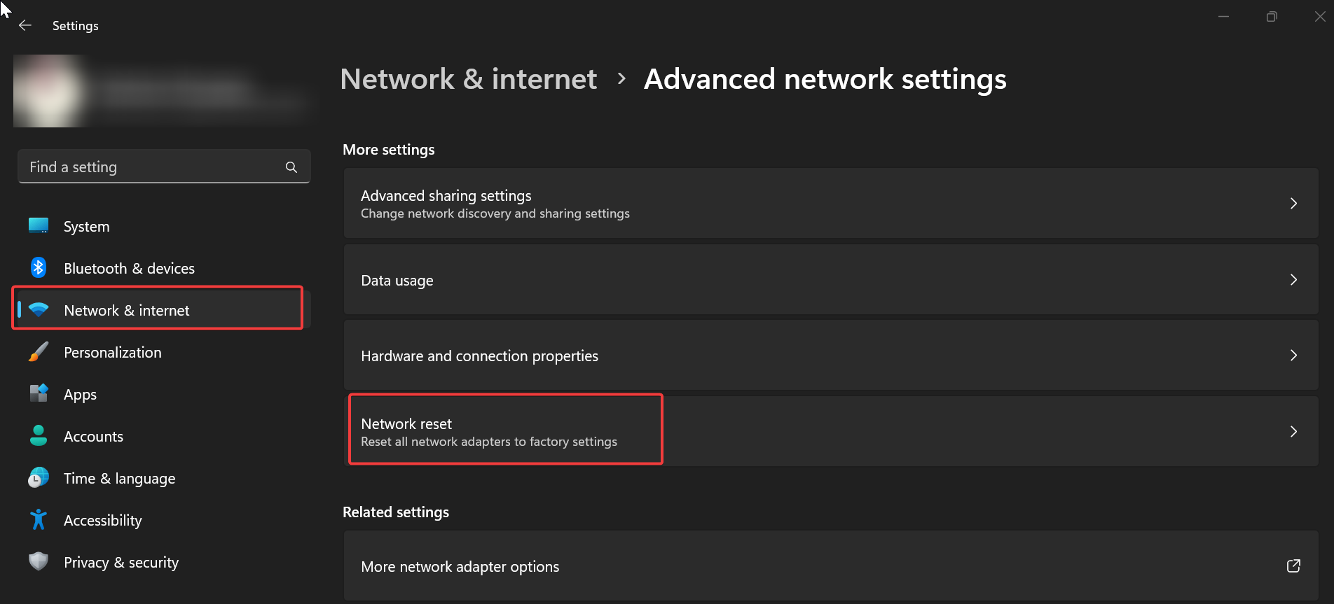 Advanced network settings